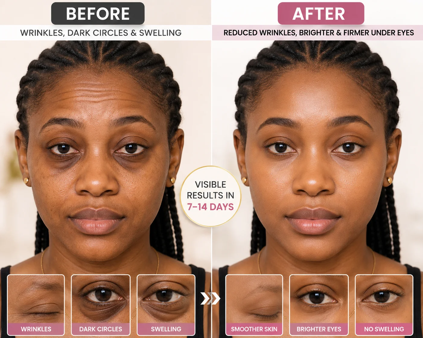 Stressed and fatigued person suffering from dark circles and wrinkles